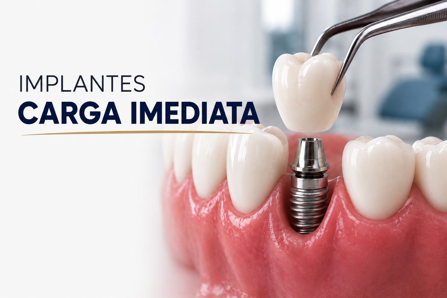Paciente com dentes fixos instalados por técnica de carga imediata